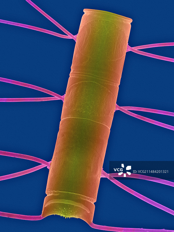 角毛藻，扫描电镜图片素材