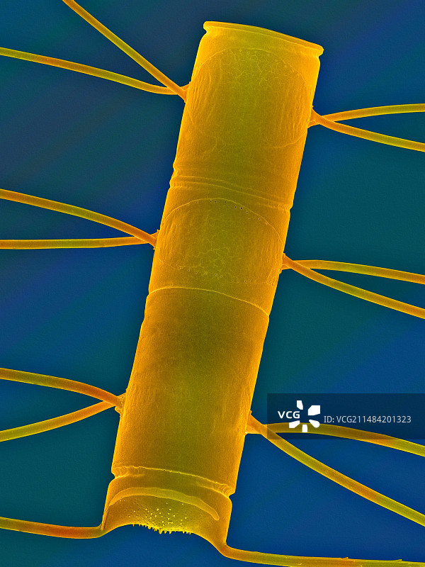 角毛藻，扫描电镜图片素材