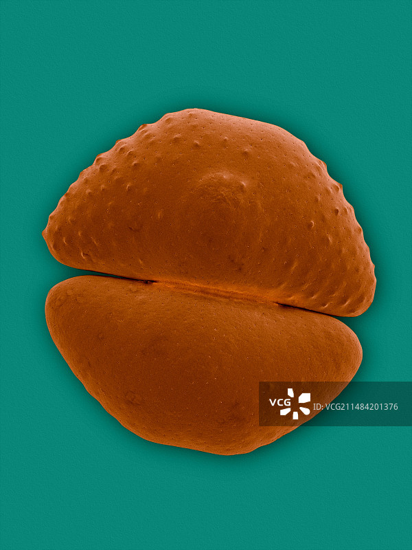 瓶状鼓藻，扫描电镜图片素材