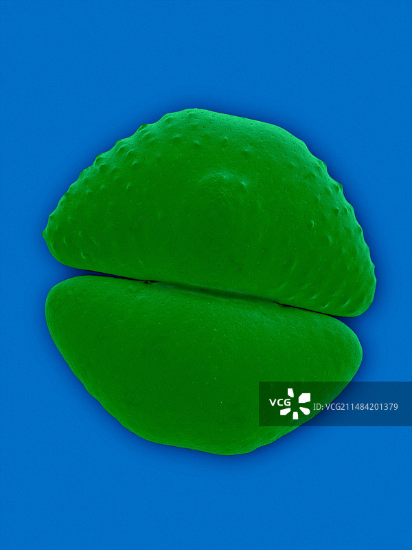 瓶状鼓藻，扫描电镜图片素材