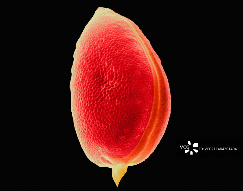 甲藻扫描电镜照片图片素材