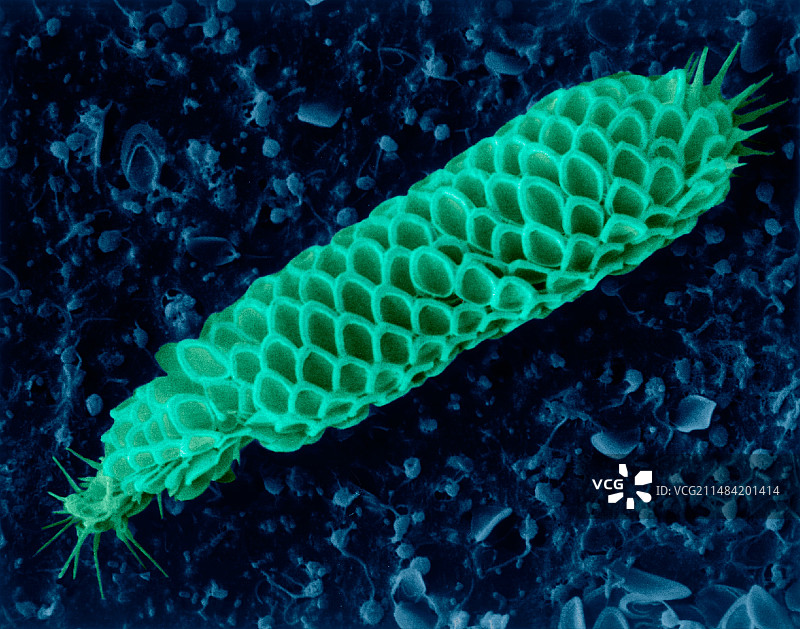 金色藻类(Mallomonas sp.)扫描电镜图图片素材