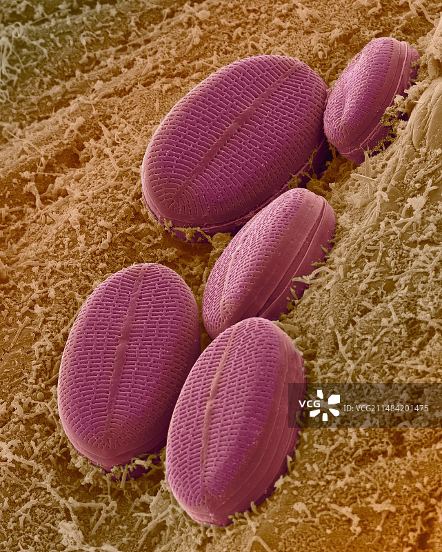 淡水羽纹硅藻，扫描电镜图片素材