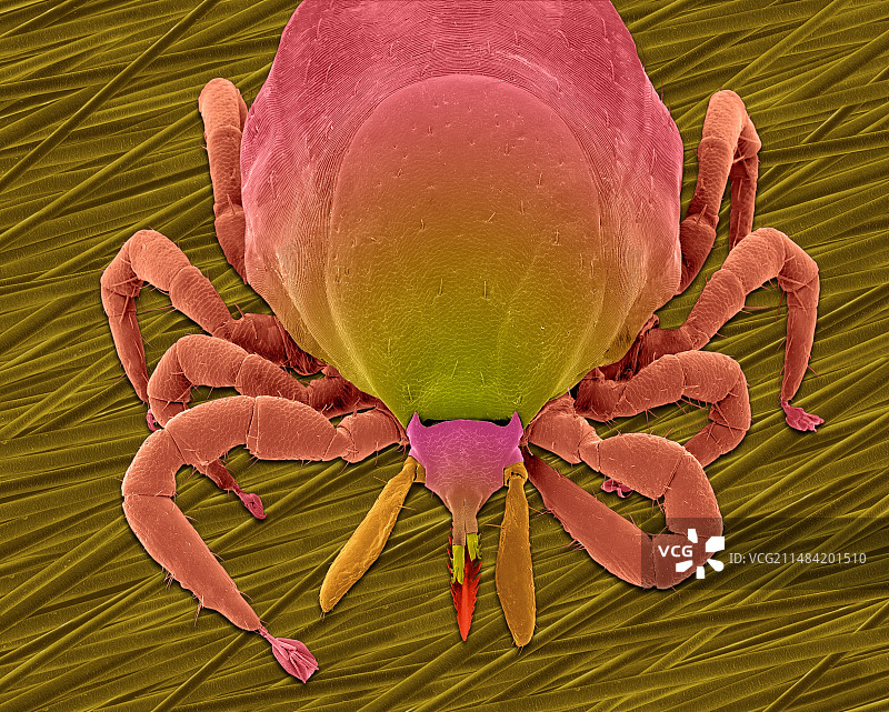 鹿蜱（肩胛硬蜱）扫描电镜图图片素材