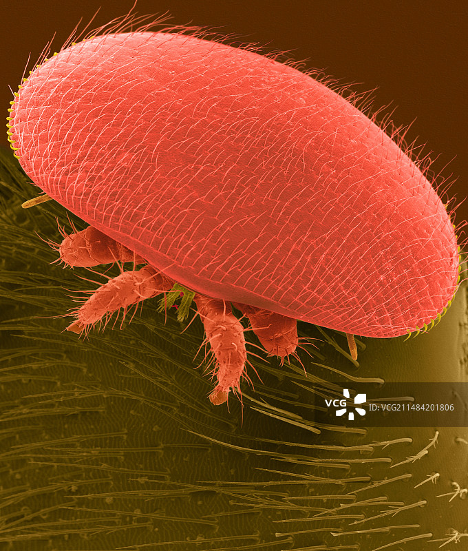 瓦螨（ destructor），扫描电镜图片素材