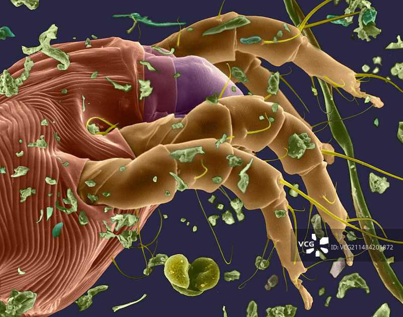 尘螨，扫描电子显微镜图片素材