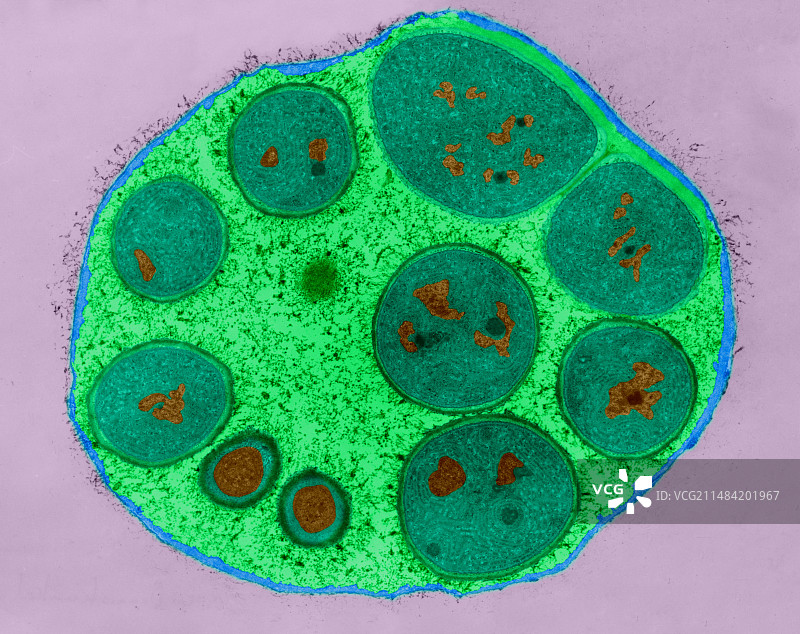 蓝细菌内生孢子（Dermocarpa sp.）TEM图片素材