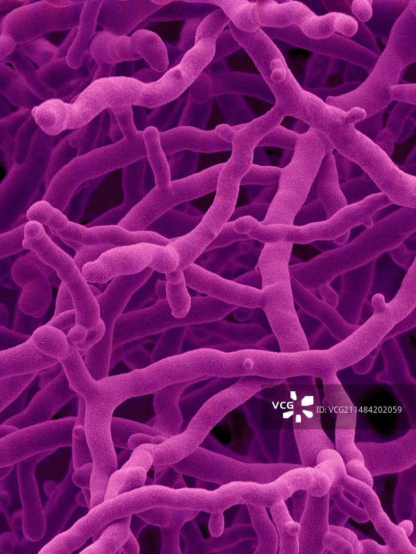 马舒链霉菌，扫描电子显微镜图片素材