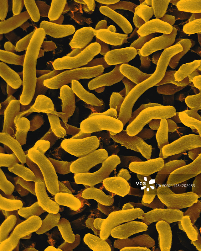 嗜盐弧菌扫描电镜图图片素材