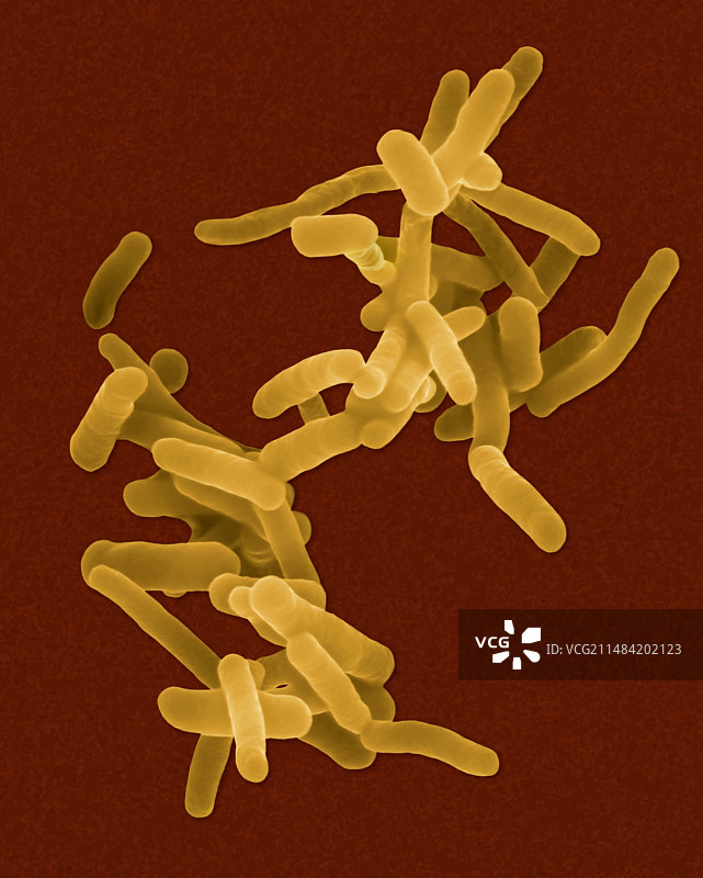 痢疾志贺菌，细菌，扫描电镜图片素材