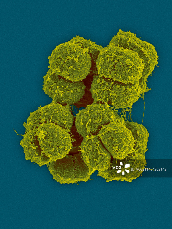 南极微球菌细菌扫描电镜图图片素材