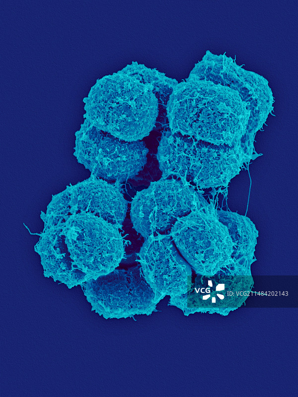 南极微球菌细菌扫描电镜图图片素材