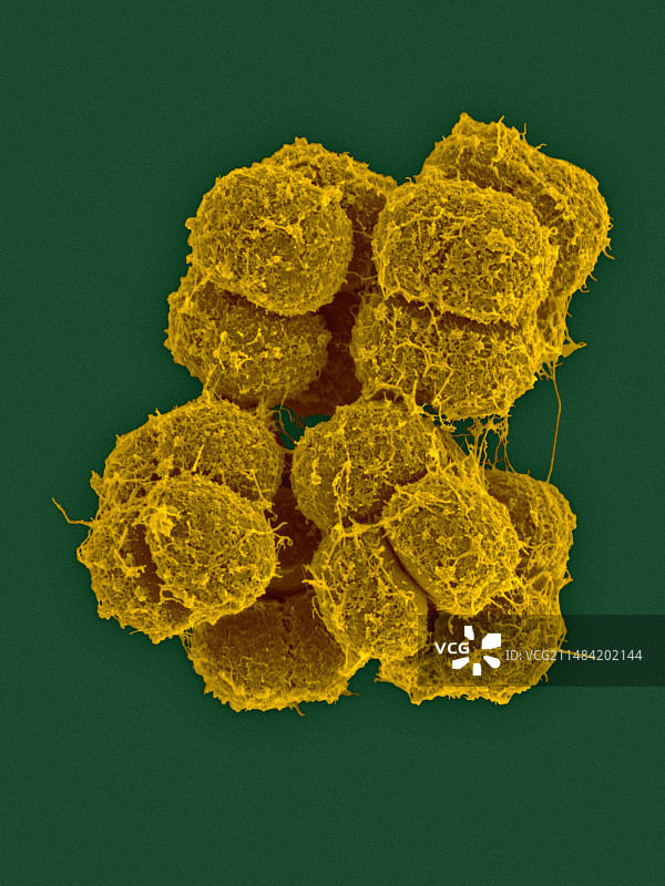 南极微球菌细菌扫描电镜图图片素材