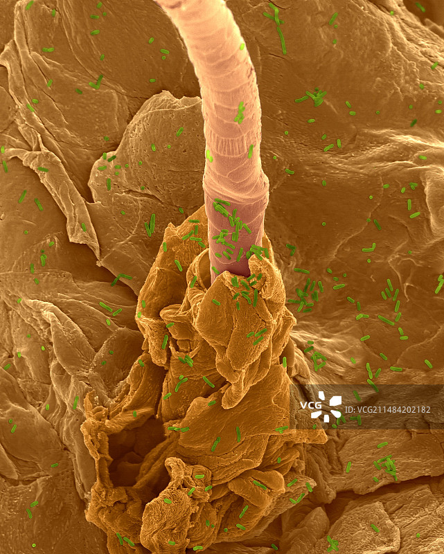 人皮肤和毛囊上的大肠杆菌扫描电镜图图片素材