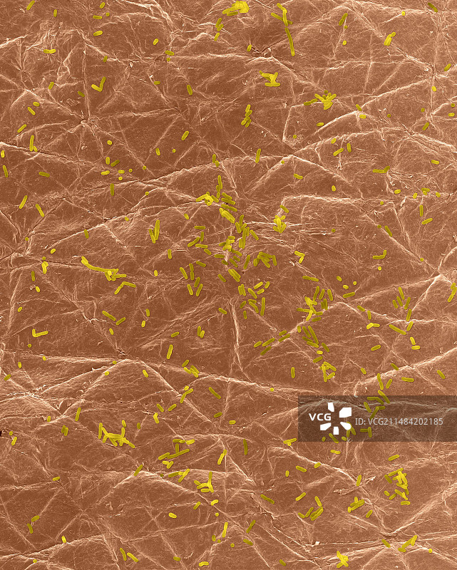 人皮肤表面的大肠杆菌，扫描电镜图片素材