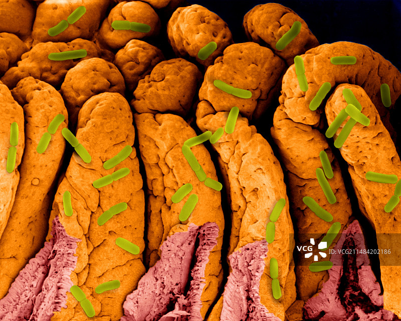 小肠表面的大肠杆菌，扫描电镜图片素材