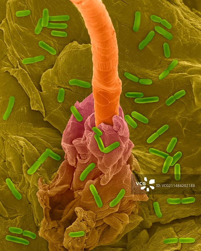 人皮肤和毛囊上的大肠杆菌扫描电镜图图片素材
