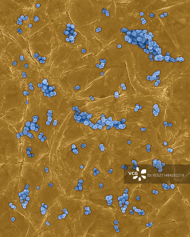 人体皮肤上的金黄色葡萄球菌（扫描电镜）图片素材