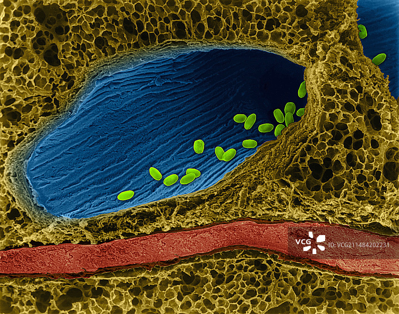 肺部炭疽杆菌孢子（扫描电镜）图片素材