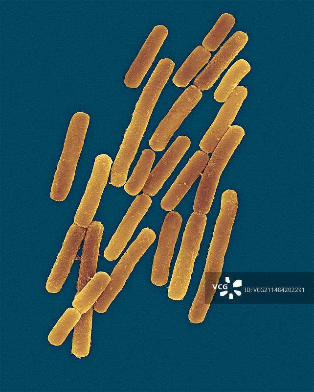 艰难梭菌孢子形成扫描电镜图图片素材