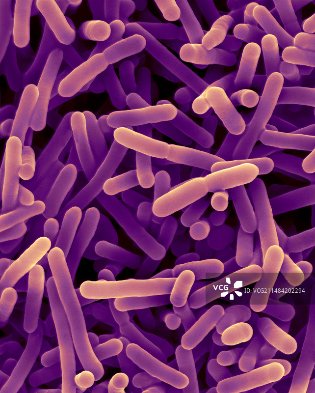 双歧杆菌属益生菌扫描电镜图图片素材