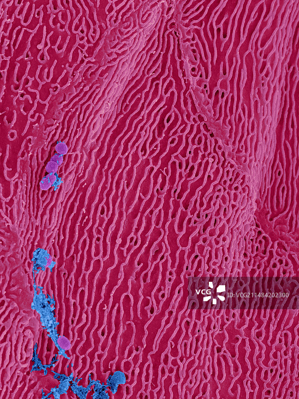 人舌乳头上的细菌，扫描电镜图图片素材