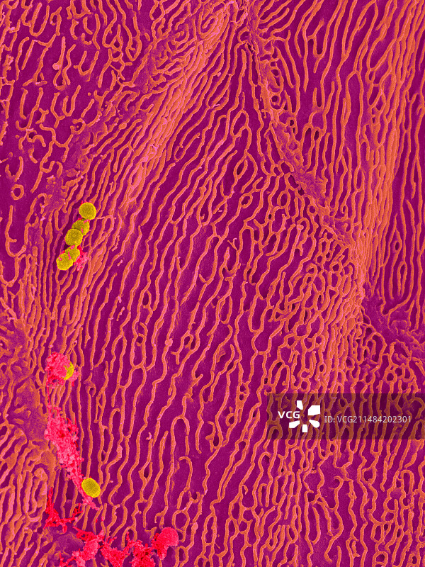 人舌乳头上的细菌，扫描电镜图图片素材