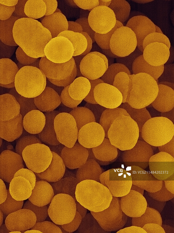 奥斯陆莫拉克斯菌，球杆菌原核生物，扫描电子显微镜图片素材