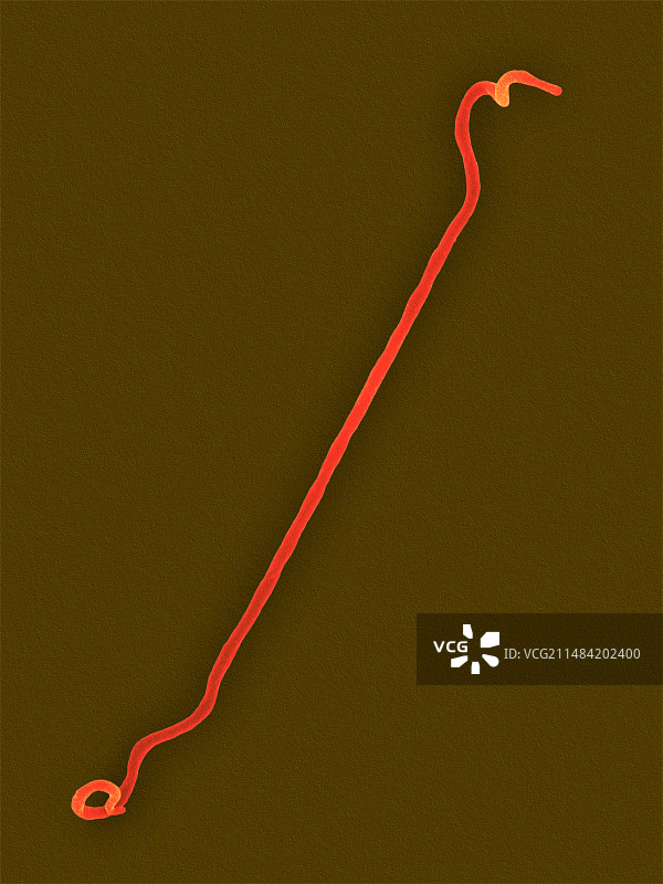 梅毒螺旋体，扫描电镜图片素材