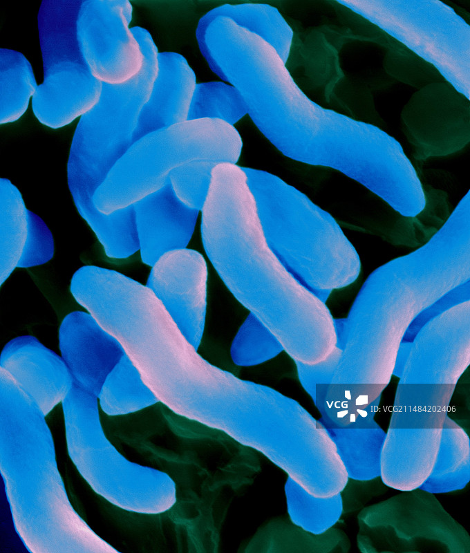 寻常脱硫弧菌扫描电镜图图片素材