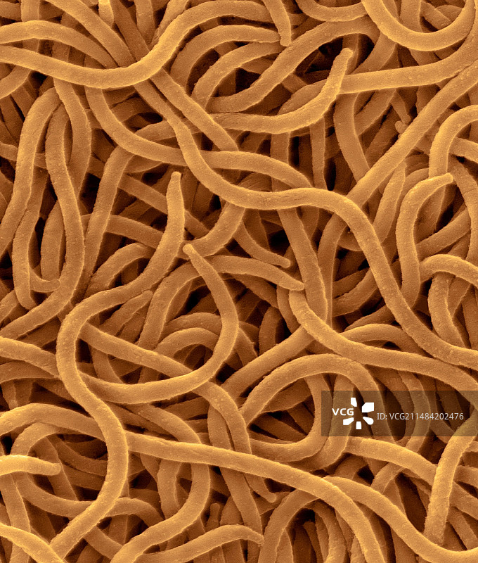 猪痢疾劳氏螺旋体，原核生物，扫描电镜图片素材