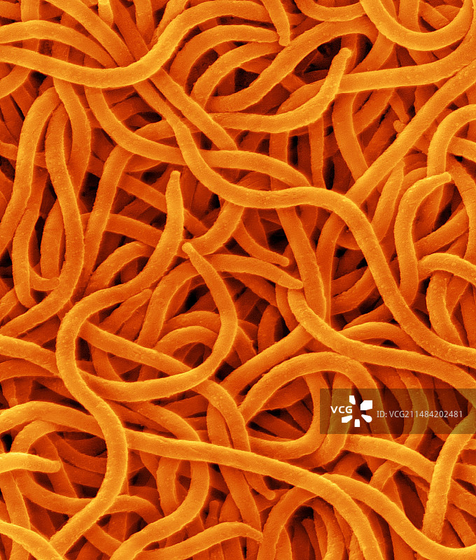 猪痢疾劳氏螺旋体，原核生物，扫描电镜图片素材