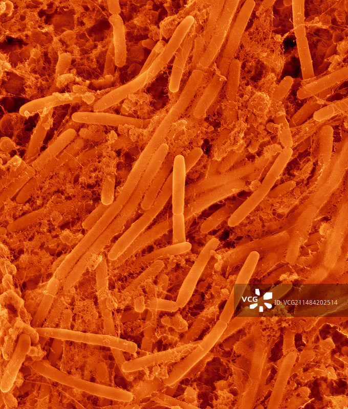 口腔细菌：粘性放线菌，扫描电镜图片素材