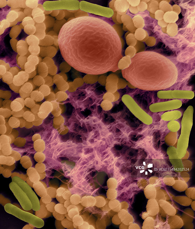 细菌（杆菌和球菌）和酵母菌，扫描电镜图片素材