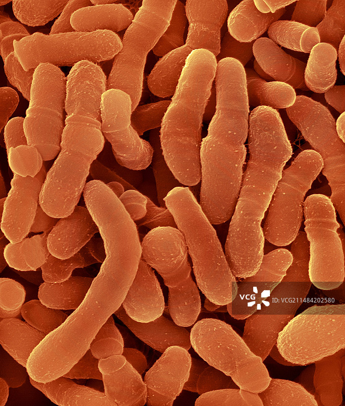 结核硬脂酸棒状杆菌，扫描电镜图片素材