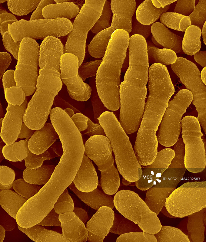 结核硬脂酸棒状杆菌，扫描电镜图片素材