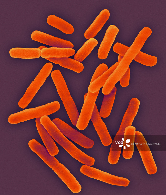 大肠杆菌(0157:H7)，杆状，出血性细菌，扫描电镜图片素材