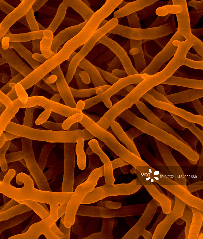 波戈纳糖多孢菌，土壤放线菌，扫描电镜图片素材