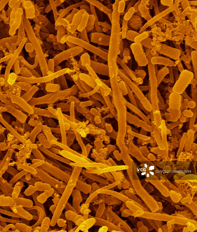 人口腔细菌扫描电镜图图片素材