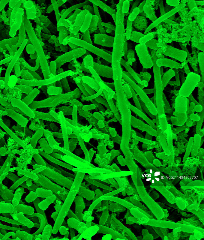 人口腔细菌扫描电镜图图片素材