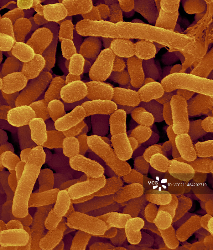 牛瘤胃细菌，SEM图像图片素材