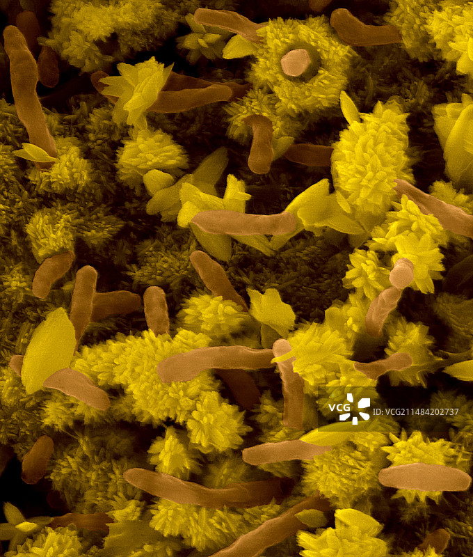 氧化铁红细菌扫描电镜图图片素材