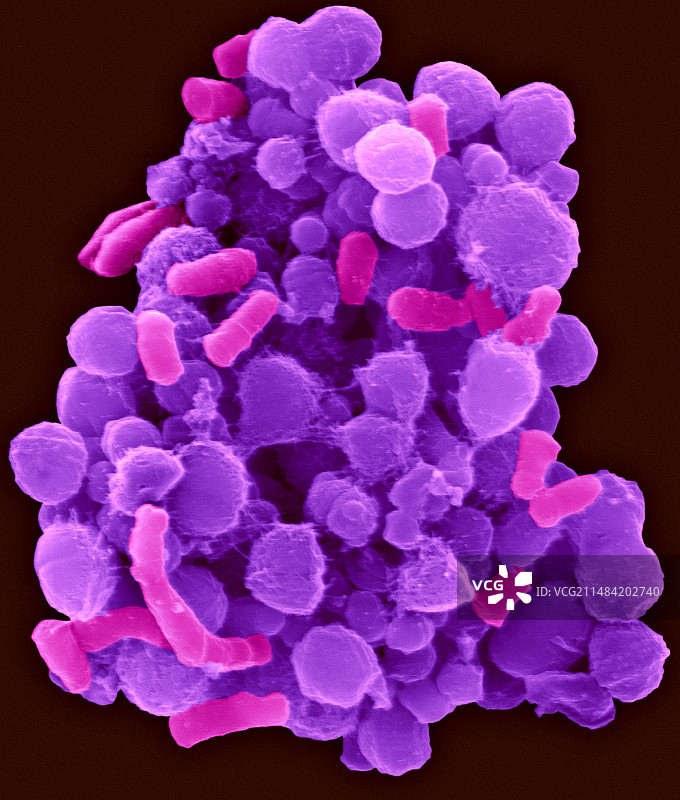 人体舌头口腔细菌，扫描电镜图片素材