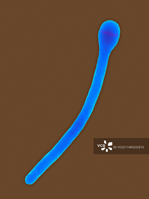 植物发酵梭菌扫描电镜照片图片素材