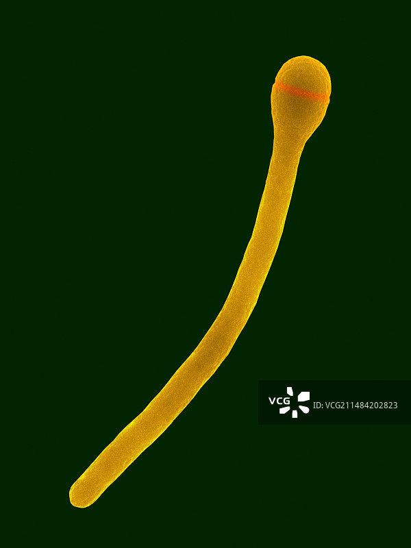 植物发酵梭菌扫描电镜照片图片素材