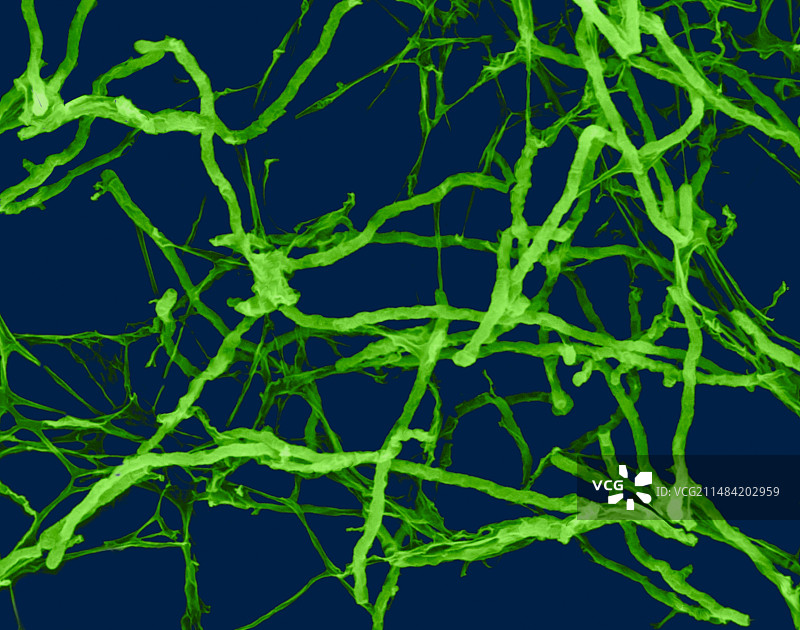 丝状细菌（链霉菌属），扫描电子显微镜图片素材