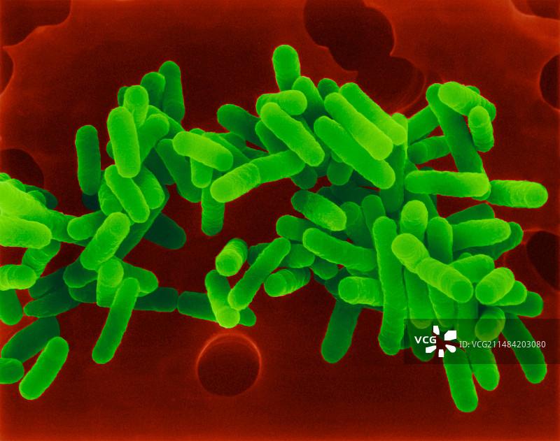嗜肺军团菌细菌扫描电镜图图片素材