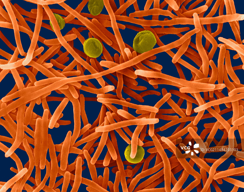 赭色噬二氧化碳菌扫描电镜图图片素材