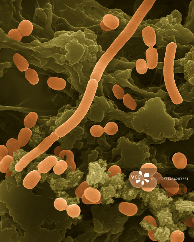 不动杆菌属，SEM图片素材