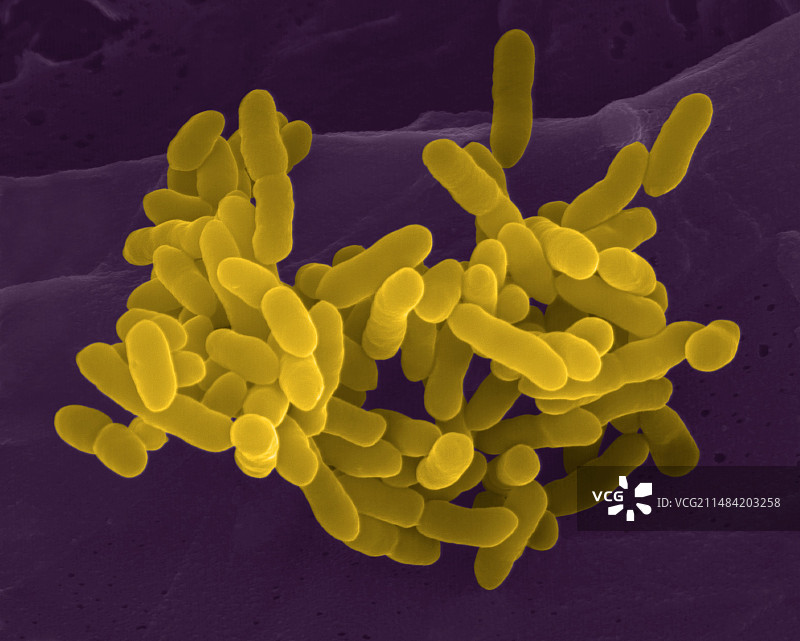 奇异变形杆菌扫描电镜图像图片素材